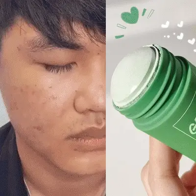 Green Mask Stick A Game-Changer for Glowing Skin